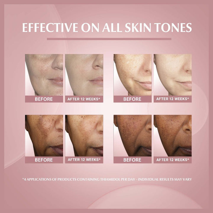 Even Pigment Perfector GGlow Serum