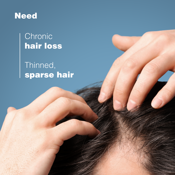 Ducray Anaphase Anti-hair loss Anti-thinning Shampoo