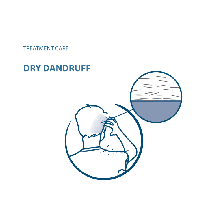 Ducray Kelual squanorm anti-dandruff treatment shampoo - Dry dandruff