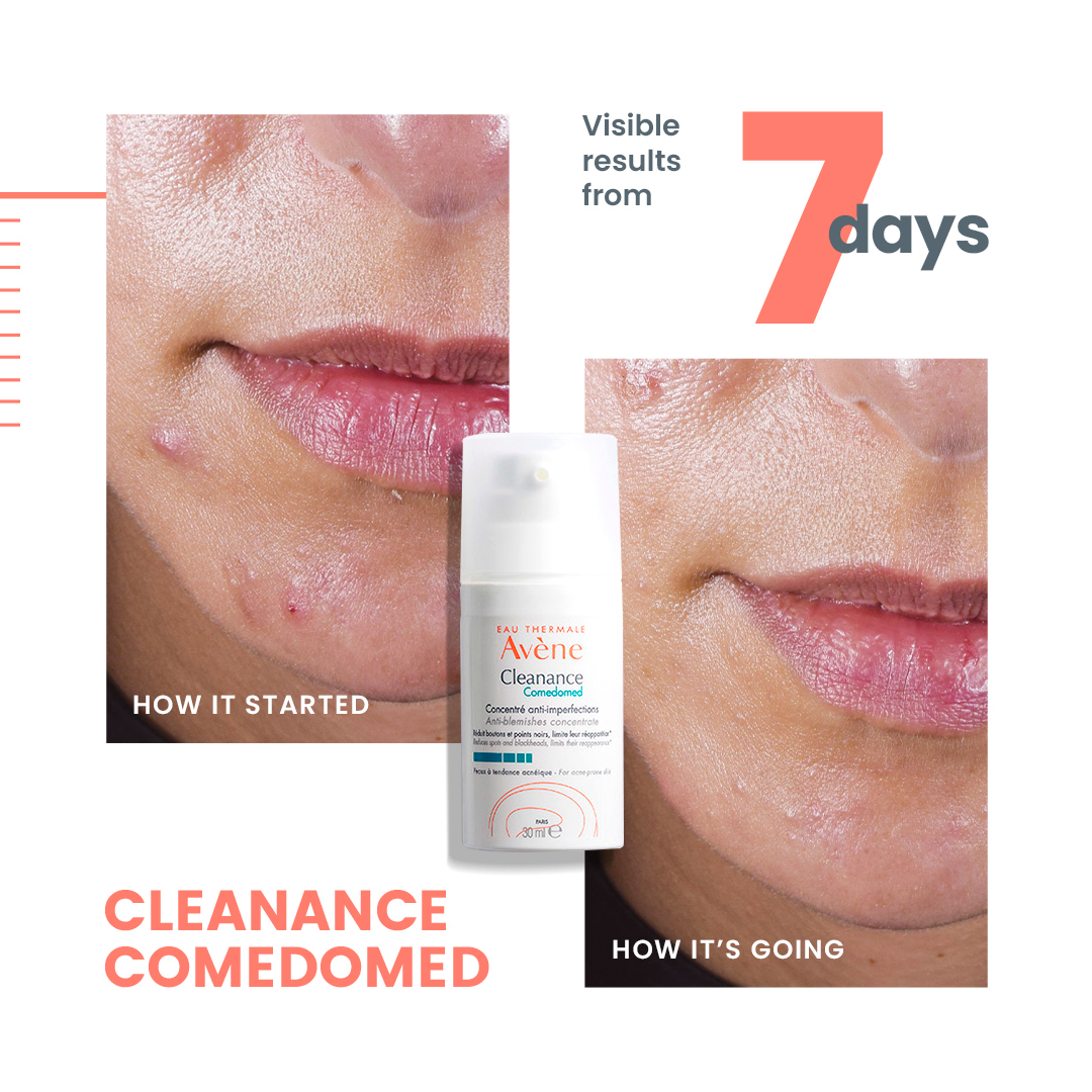 Avène Cleanance Comedomed Anti-Blemish Concentrate